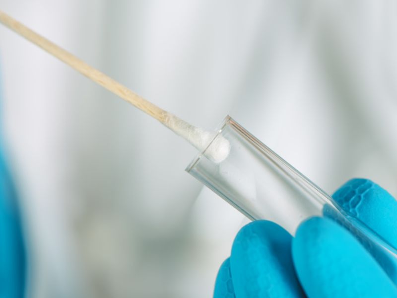 genetic test